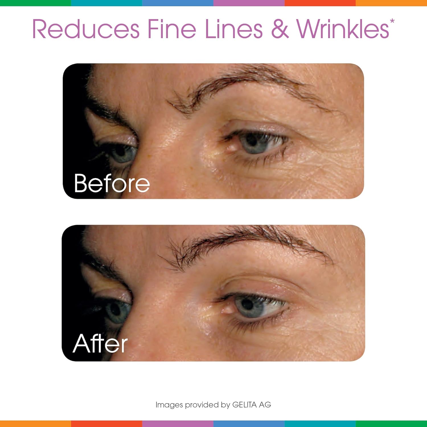 3-Pack Sparkle Wellness Skin Boost Plus (Mixed Berry) - Collagen Powder with VERISOL Peptides, Vitamin C, and Hyaluronic Acid for Improved Skin Elasticity