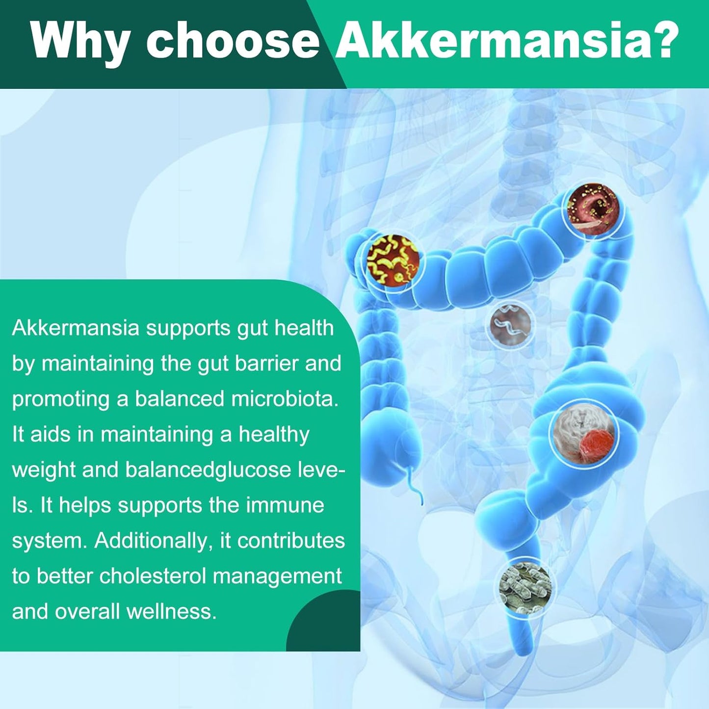 30 Day Supply of inGreens Akkermansia Muciniphila Probiotic with Chicory Inulin, Turmeric, Resistant Starch - Vegan & Gluten Free Gut Management Supplement