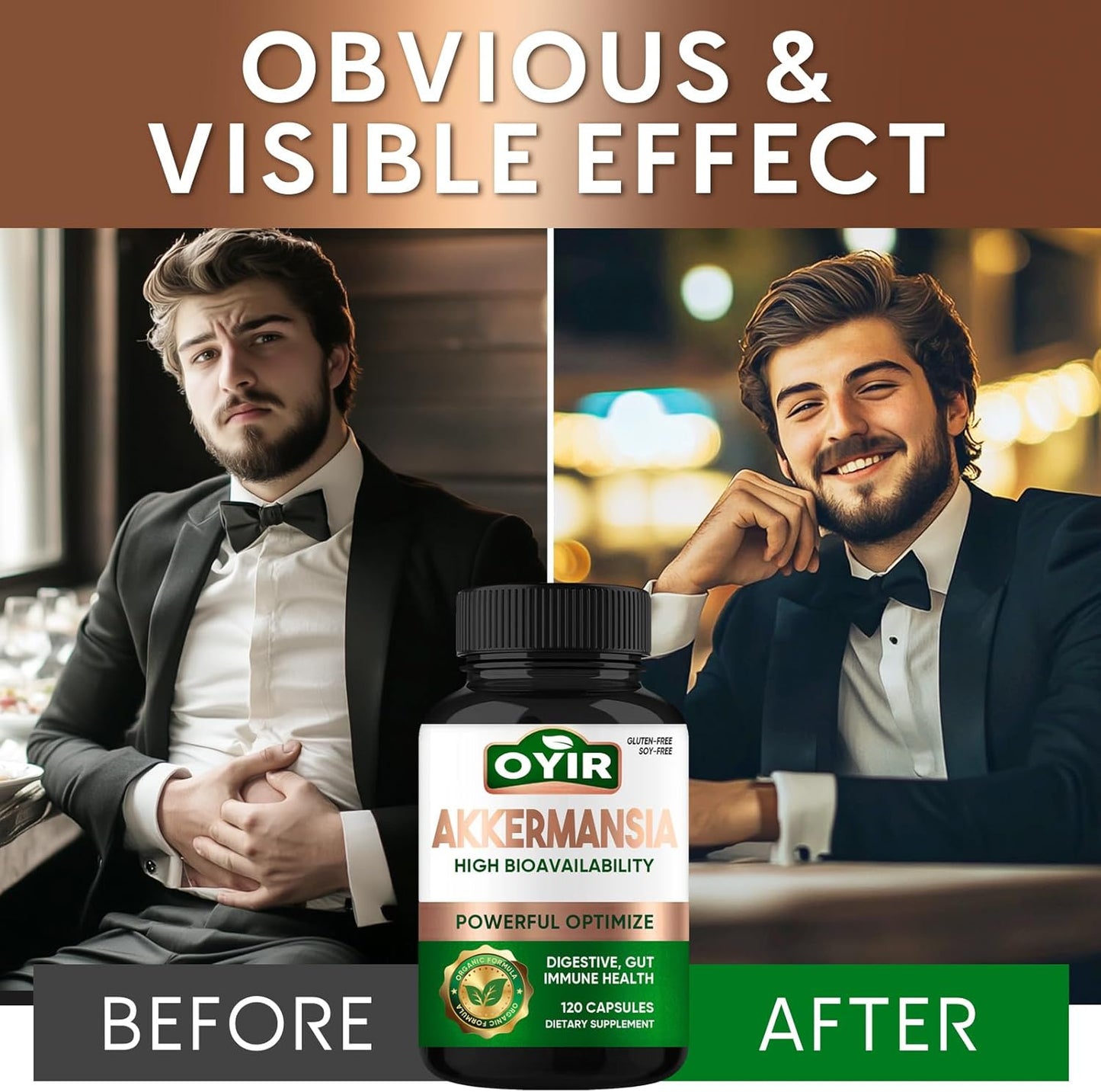 300 Billion AFU Akkermansia Probiotic Supplement for Digestive & Immune Support - GLP-1 Probiotic for Gut Health - Men & Women's Overall Wellness Boost