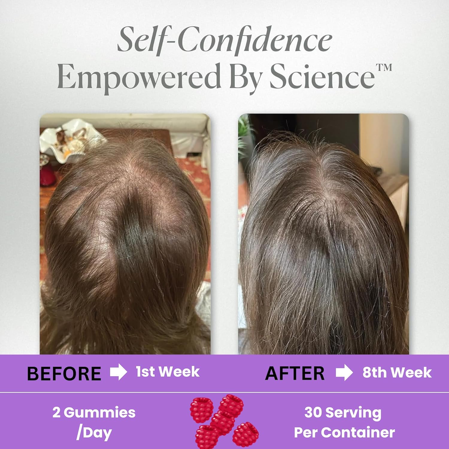 5000 Mcg Biotin Vegan Gummies for Hair, Skin, Nails - Men & Women - Healthy Growth, Strong Nails, Radiant Skin - 10X Strength Formula