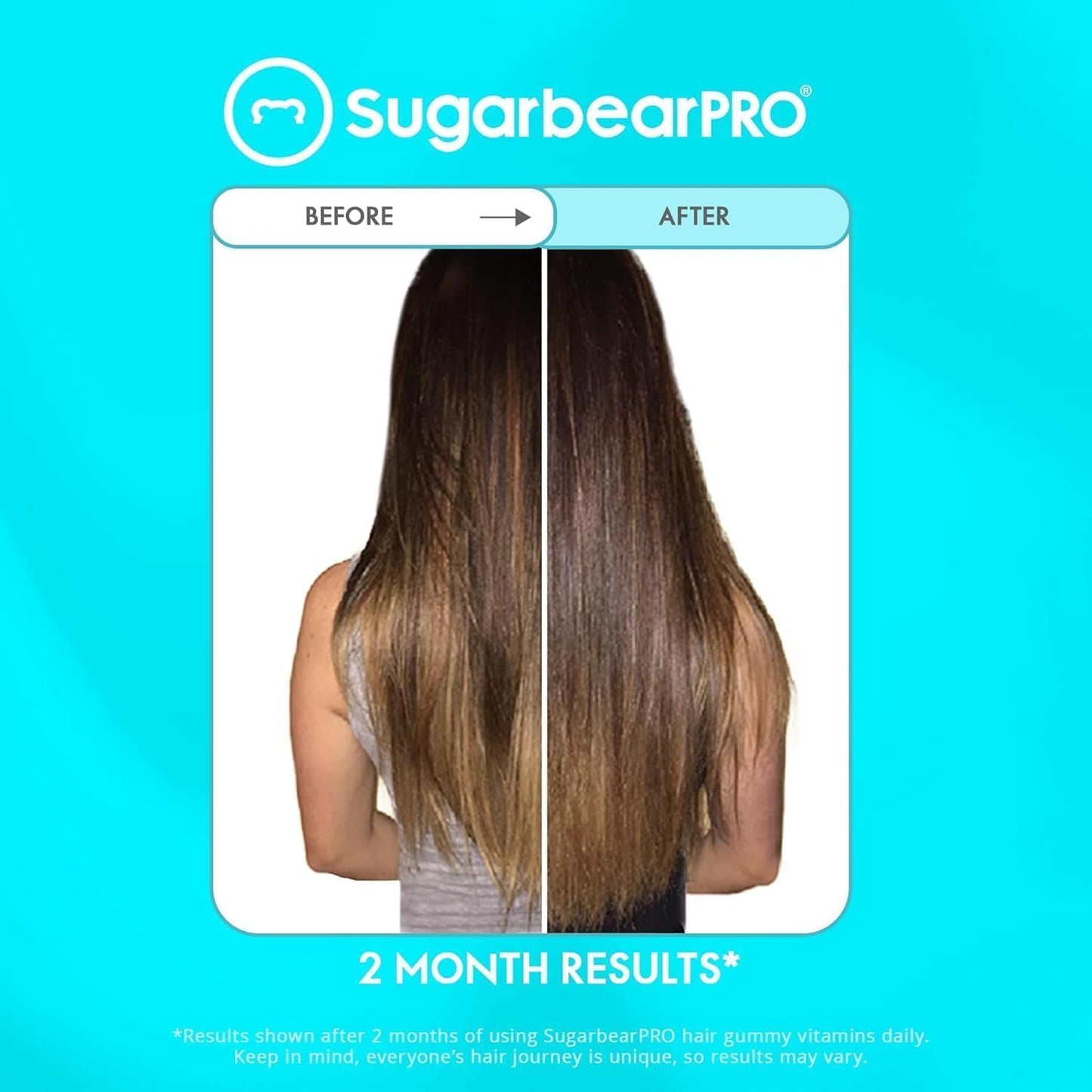 6 Month Supply of SugarbearPro Gentle Detangling Bamboo Hair Brush & Vegan Hair Vitamin Gummies with Extra Strength Biotin 6000mcg for Healthy Hair Types