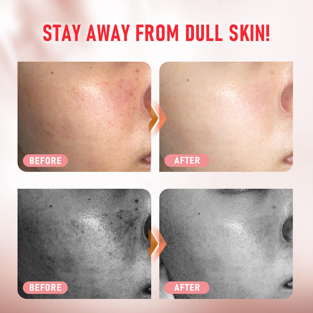 Advanced Brightening Vitamin C Treatment Ampoule with Vitamin E & Ferulic Acid - Targets Dark Spots, Scars, Dullness - 0.35 Oz