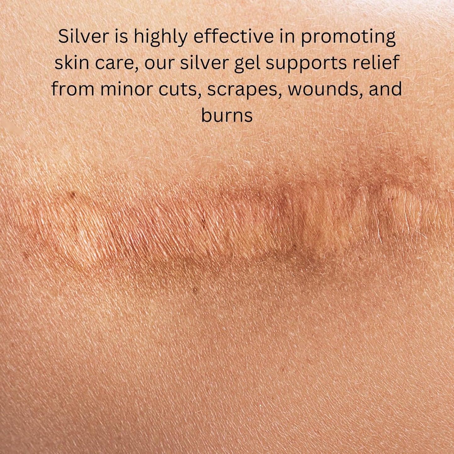 Ameo Life 35 ppm Colloidal Silver Gel - pH Balanced, Extra Strength Silver Gel for Skin Care, Cuts, Scrapes & Burns - 100ml