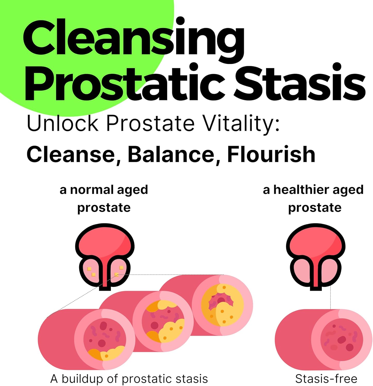 AOLYM Prost-Care Herbal Formula for Men's Pelvic Wellness & Prostate Health - 120 Packets