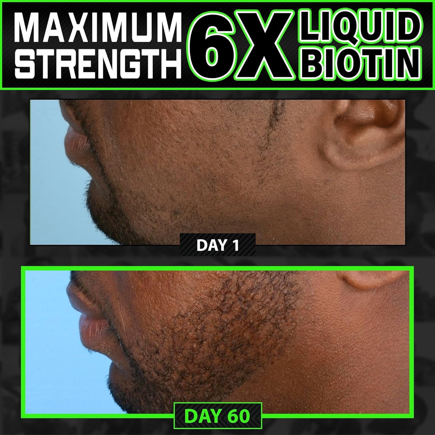 BBS USA Maximum Strength Biotin & Collagen Liquid for Men Hair & Beard Growth - 6X Absorption (2 OZ)
