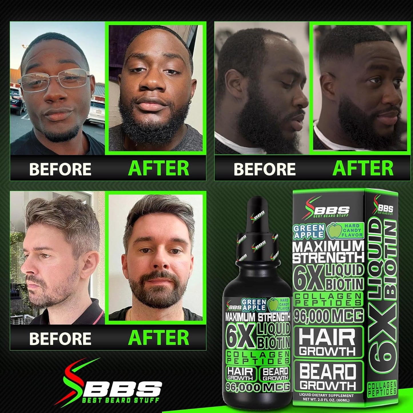 BBS USA Maximum Strength Biotin & Collagen Liquid for Men Hair & Beard Growth - 6X Absorption (2 OZ)