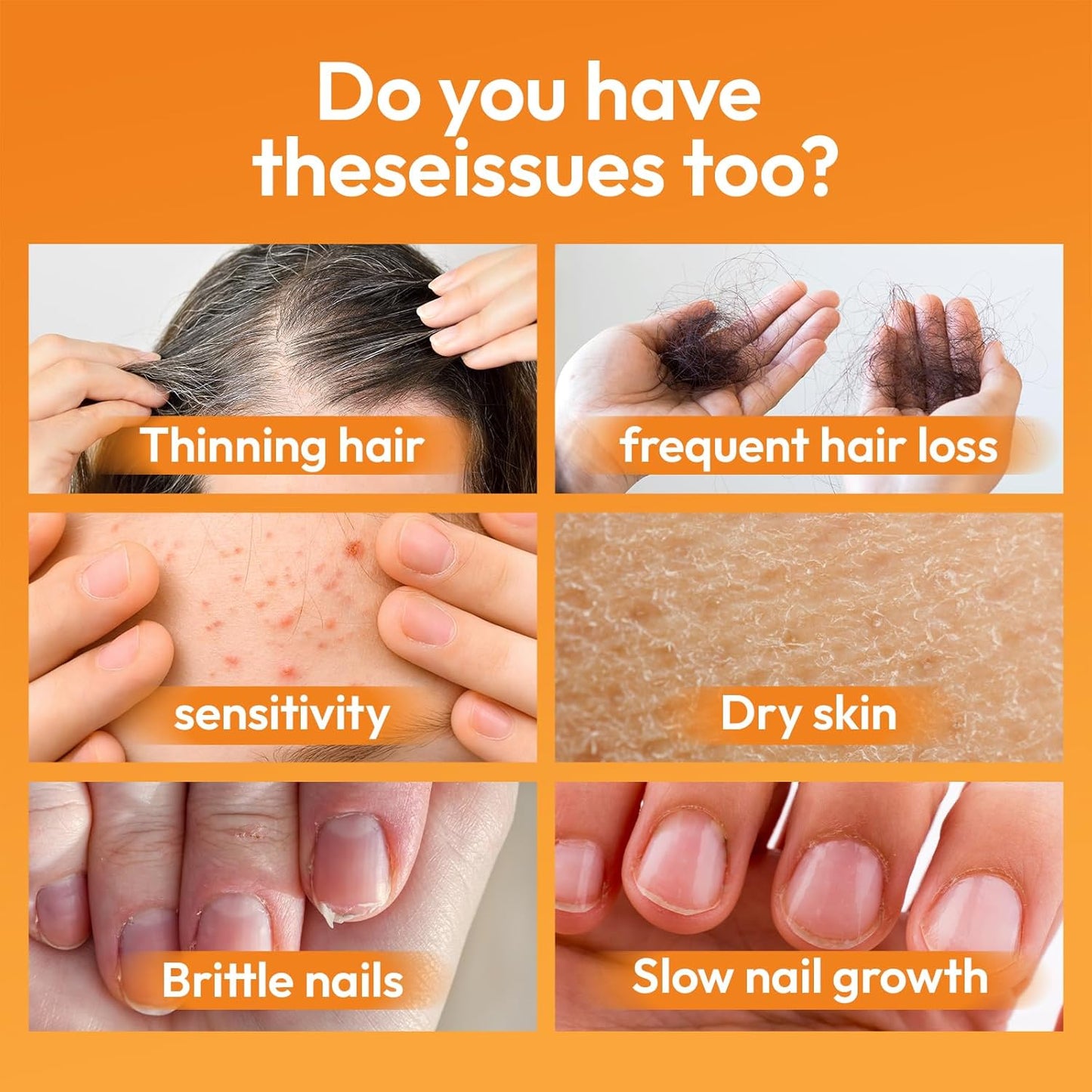 Biotin 10000 mcg with Zinc, Vitamin C & Calcium Pantothenate - Hair, Nails & Skin Support - 60 Vegan Capsules - USA Made