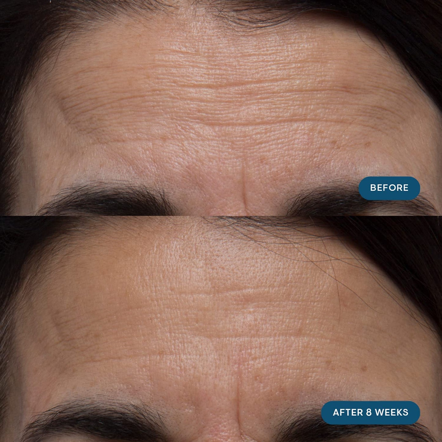 ELEMIS Pro-Collagen Skin Future Supplements - Reduce Fine Lines & Wrinkles, Hydrate & Improve Elasticity - 60 Capsules