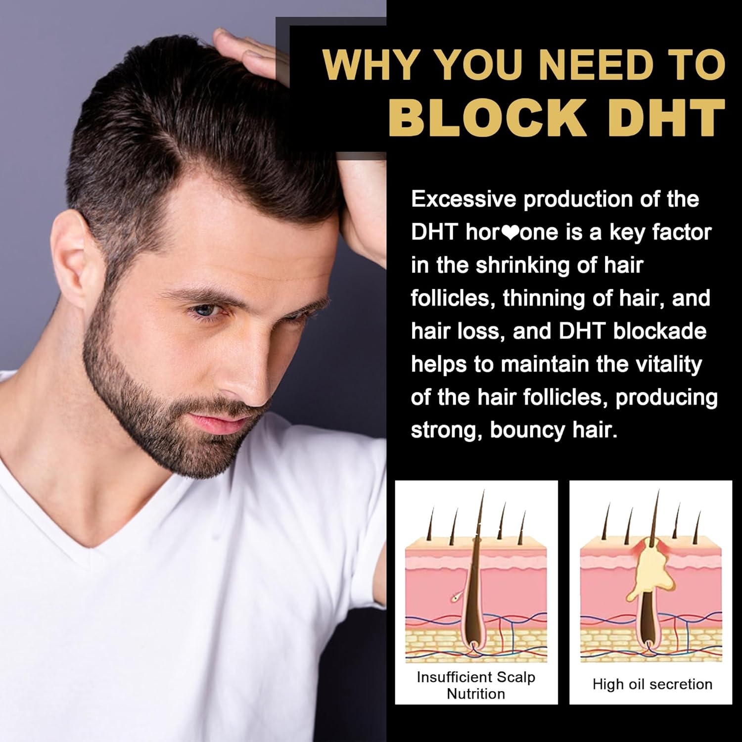 EnvyDeal DHT Blocker Gummies Hair Growth Supplement with Saw Palmetto & Biotin - Prevent Hair Loss, Balance Hormones, Potent Blend for Men & Women
