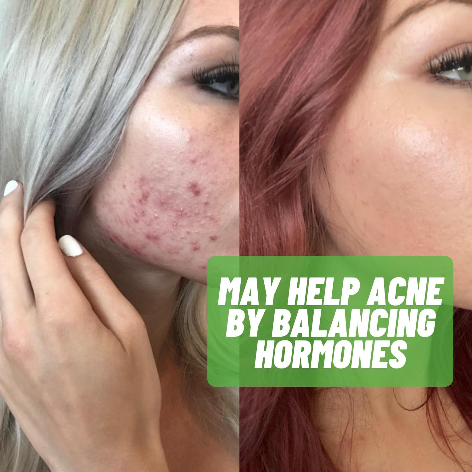 Estrohalt 2 Pack 120 Pills - Best Estrogen Blocker Supplement with DIM and I3C for Women & Men | Natural Aromatase Inhibitor for PCOS, Menopause, PMS