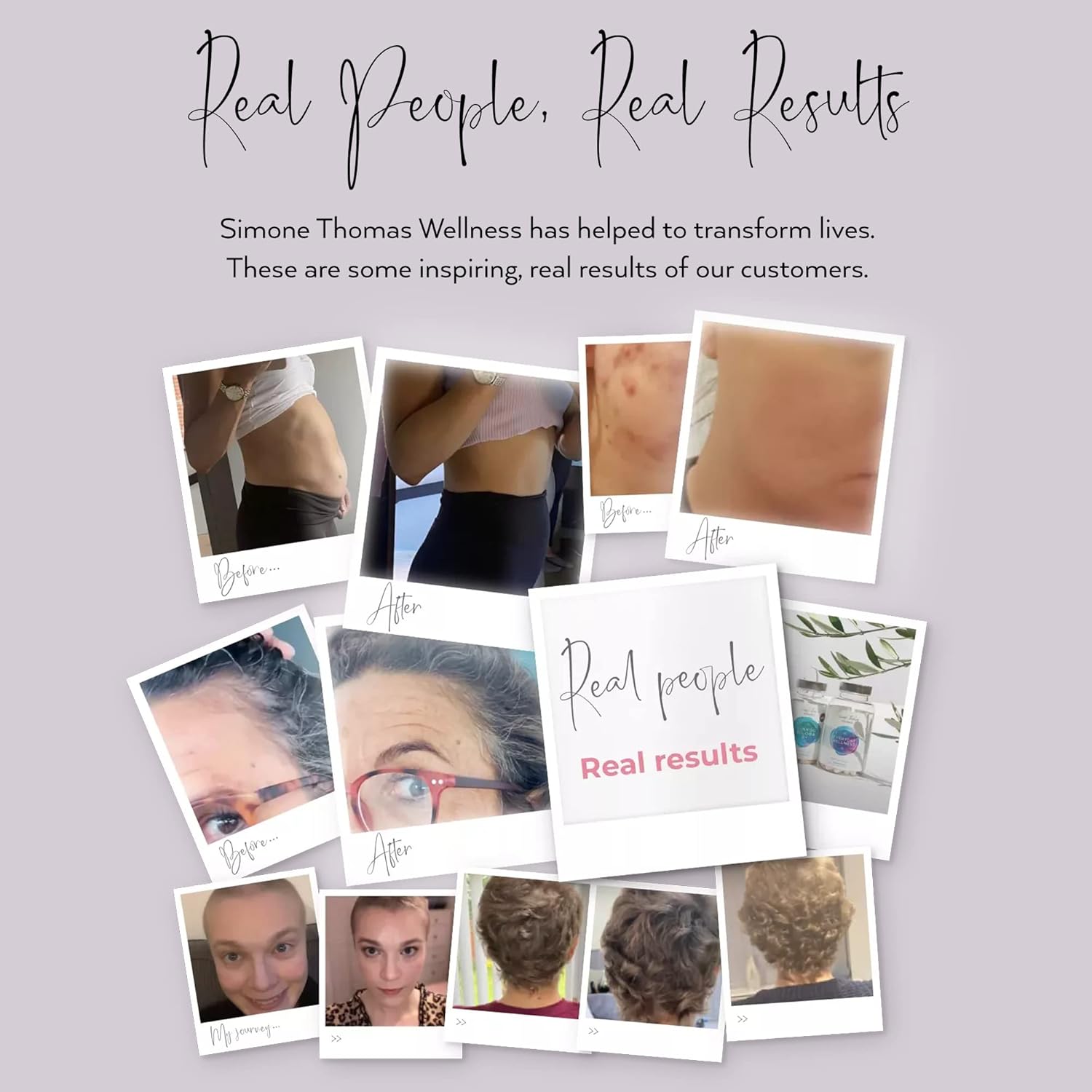 Ginkgo Biloba B+ Hair Growth Supplements for Women - 2000mg Hair Loss Vitamins with Hair Regrowth Formula (60 Capsules) by Simone Thomas Wellness