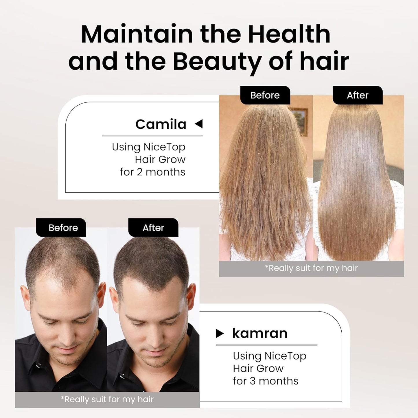 Hair Growth Supplement with Biotin, Vitamin A, C, E, Zinc - Promotes Strength, Thickness, and Growth - 60 Capsules