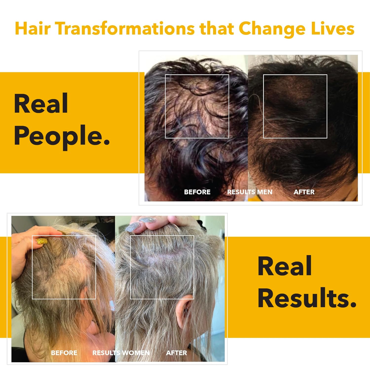 Hair ReGrowth Vitamins for Men - DHT Blocker Supplement with Saw Palmetto, Nettle, Green Tea, Pygeum Bark, Pumpkin Seed - Gluten-Free Formula - 60 Count