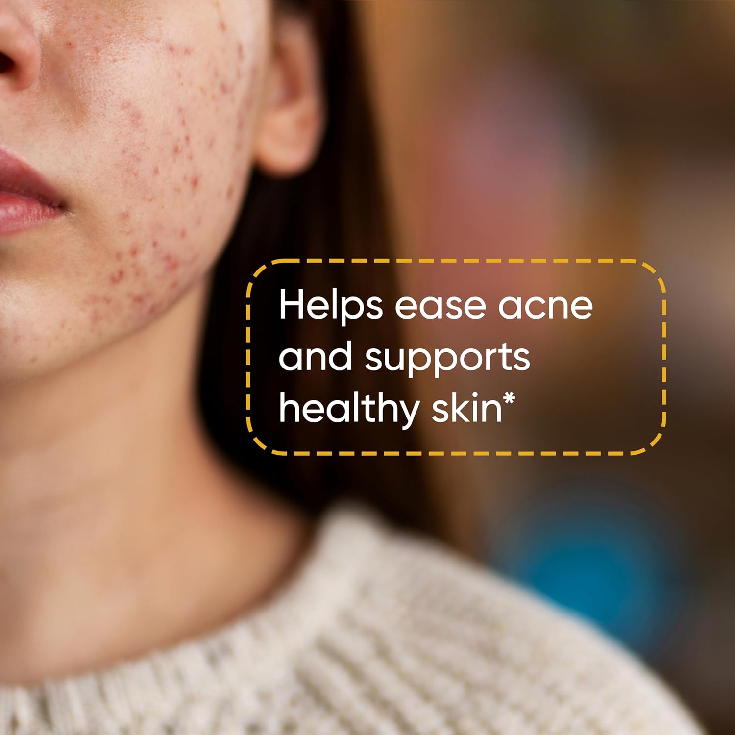 High Absorption Zinc Monomethionine Complex Supplement - 60 Capsules for Immune, Acne, and Antioxidant Support - Vegetarian Formula for Men & Women by Sandhu Herbals