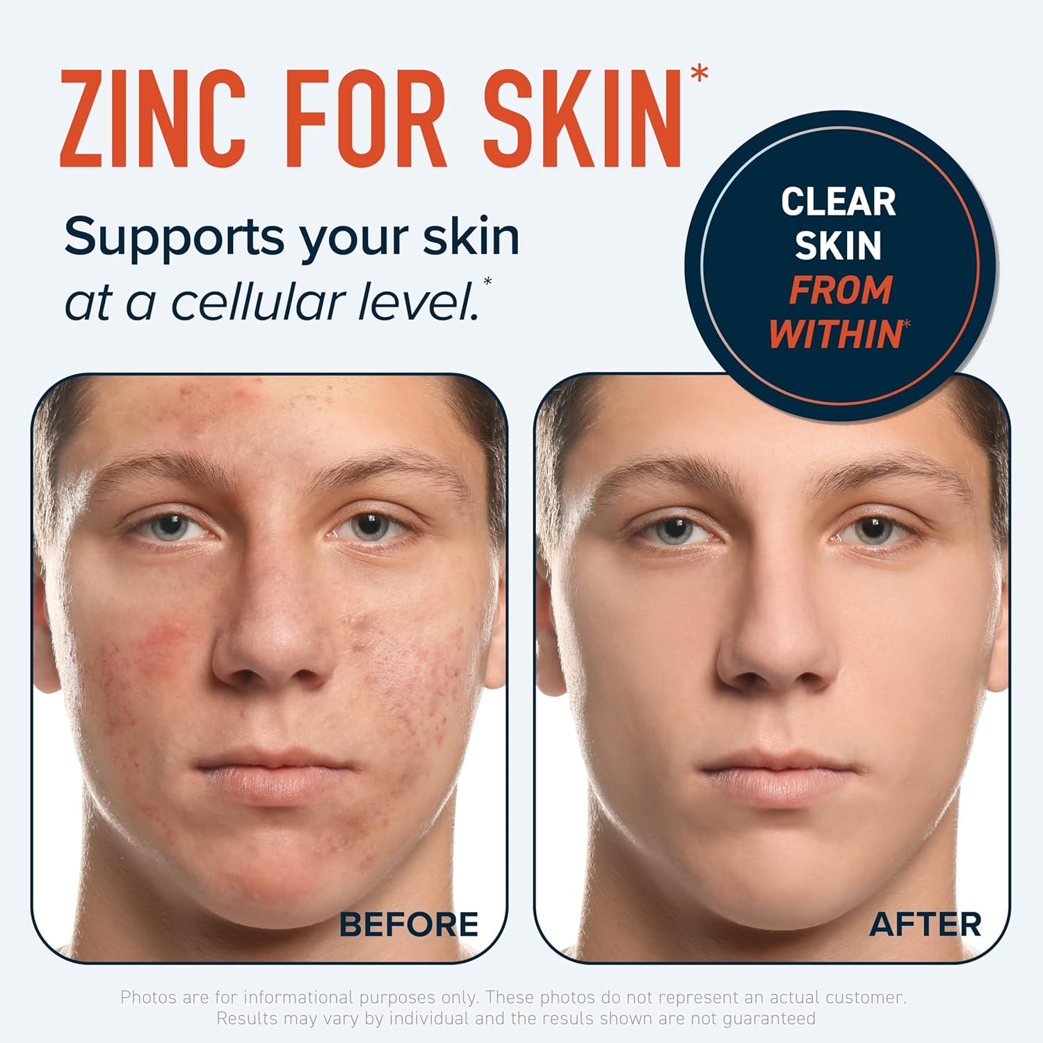 Highly Absorbable Zinc Bisglycinate Supplement for Immune & Acne Support | With Chelated Copper & Vitamin B6 | Vegan, Gluten-Free | 60 Capsules