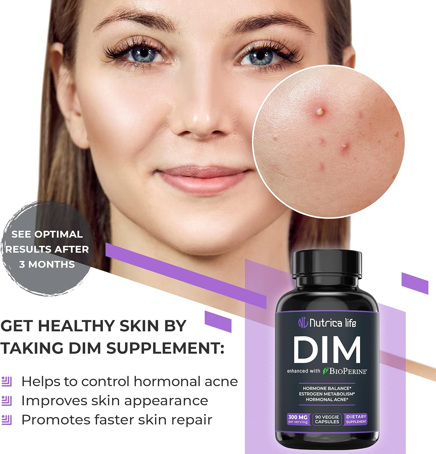 Hormone Balance Support Supplement 300mg - Diindolylmethane with Broccoli & BioPerine - Menopause Relief & Acne Control - 90 Capsules