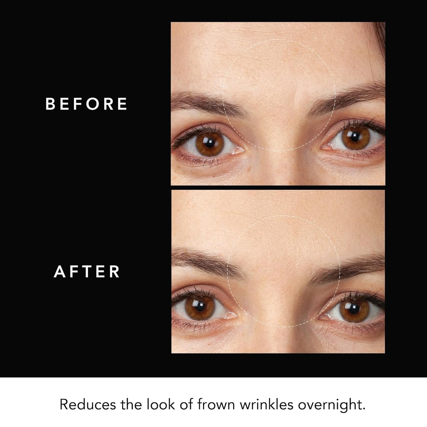 Hyaluronic Acid Forehead Patches for Rejuvenating Results - Travel-Friendly Skin Care - Pack of 3