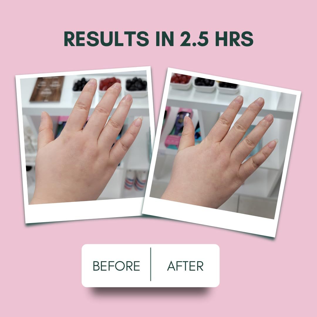 IMARAÏS Beauty by Sommer Ray Depuff Anti-Bloat Gummy with English Chamomile, Hibiscus, and Ginger - Supports Skin and Gut Health, Reduces Skin Bloat and Puffiness - Sugar Free, PETA-Certified