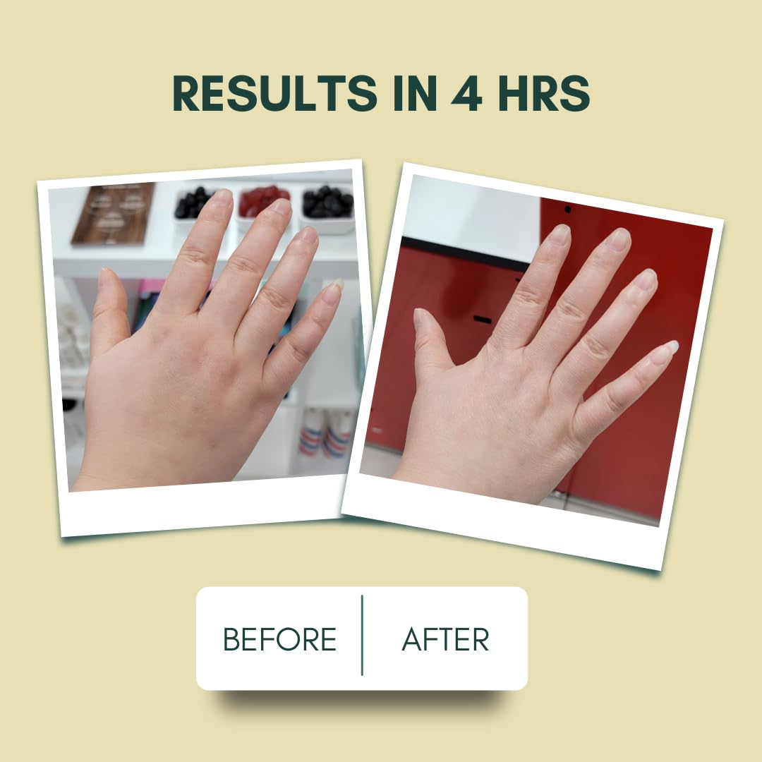 IMARAÏS Beauty by Sommer Ray Depuff Anti-Bloat Gummy with English Chamomile, Hibiscus, and Ginger - Supports Skin and Gut Health, Reduces Skin Bloat and Puffiness - Sugar Free, PETA-Certified