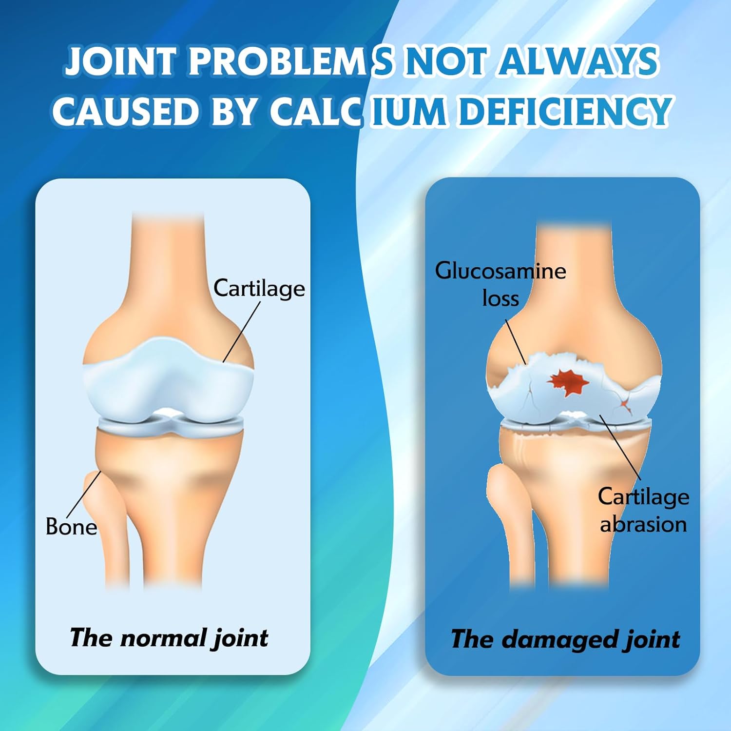 Joint Support Complex with Glucosamine, Chondroitin, MSM, Turmeric, and More - 120 Tablets for Healthy Joints and Mobility