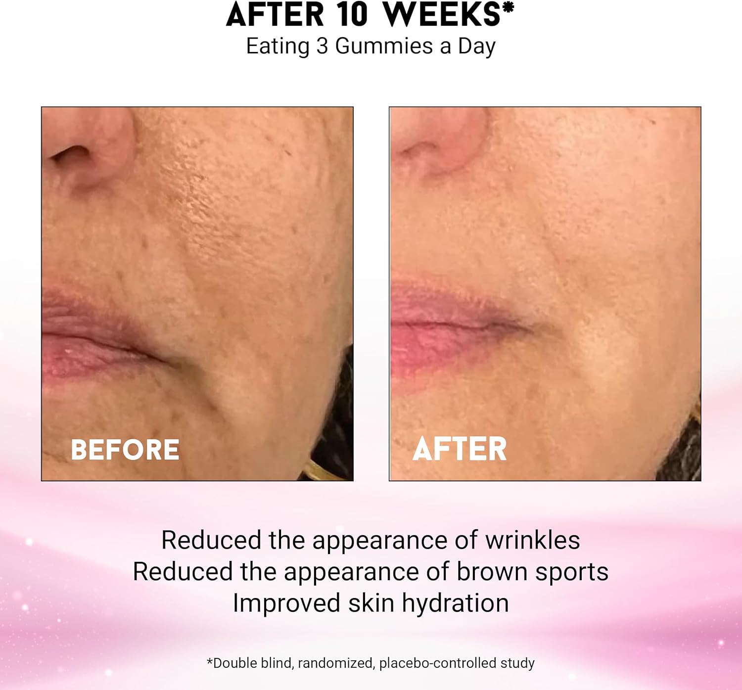 Joyce Giraud Miracle Elixir Beauty Gummies - 30-Day Supply for Hydrated Skin & Healthy Tone