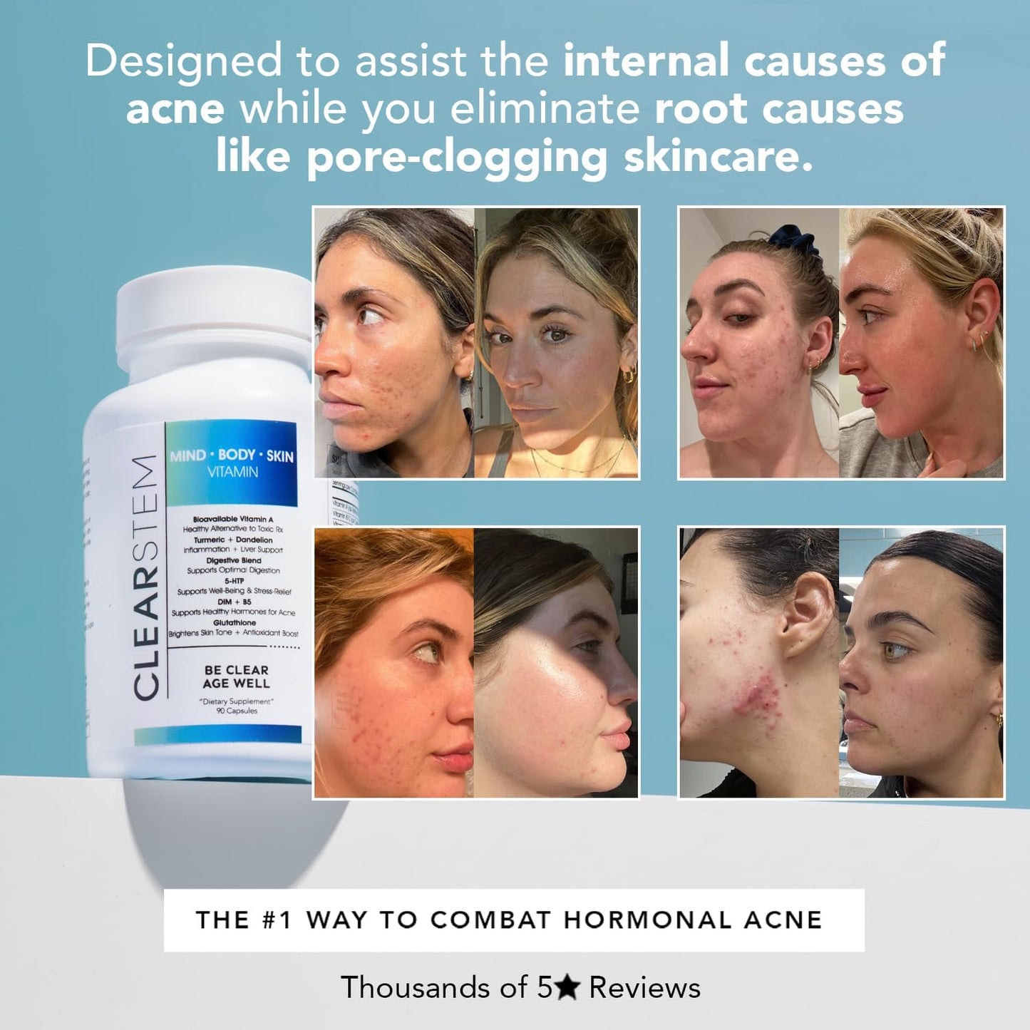 Natural Hormonal Acne Supplement with 5-HTP and DIM - Skin Care Vitamins for Hormone Balance - Vegan, Gluten Free - 90 Capsules