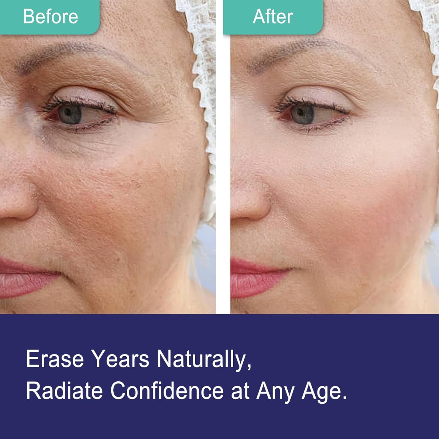 NEVISS Nicotinamide 500mg Gummies with Collagen Peptides for Healthy Aging, NAD+ Boost, and Brain Health, 120 Count