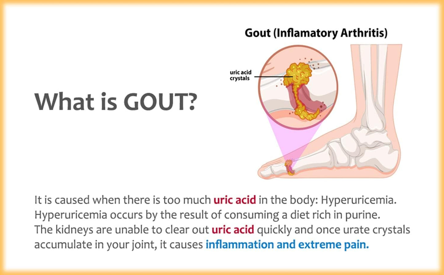 Nutridom North-American Tart Cherry Capsules - 500mg, 120 Count - Natural & Non-GMO Supplement
