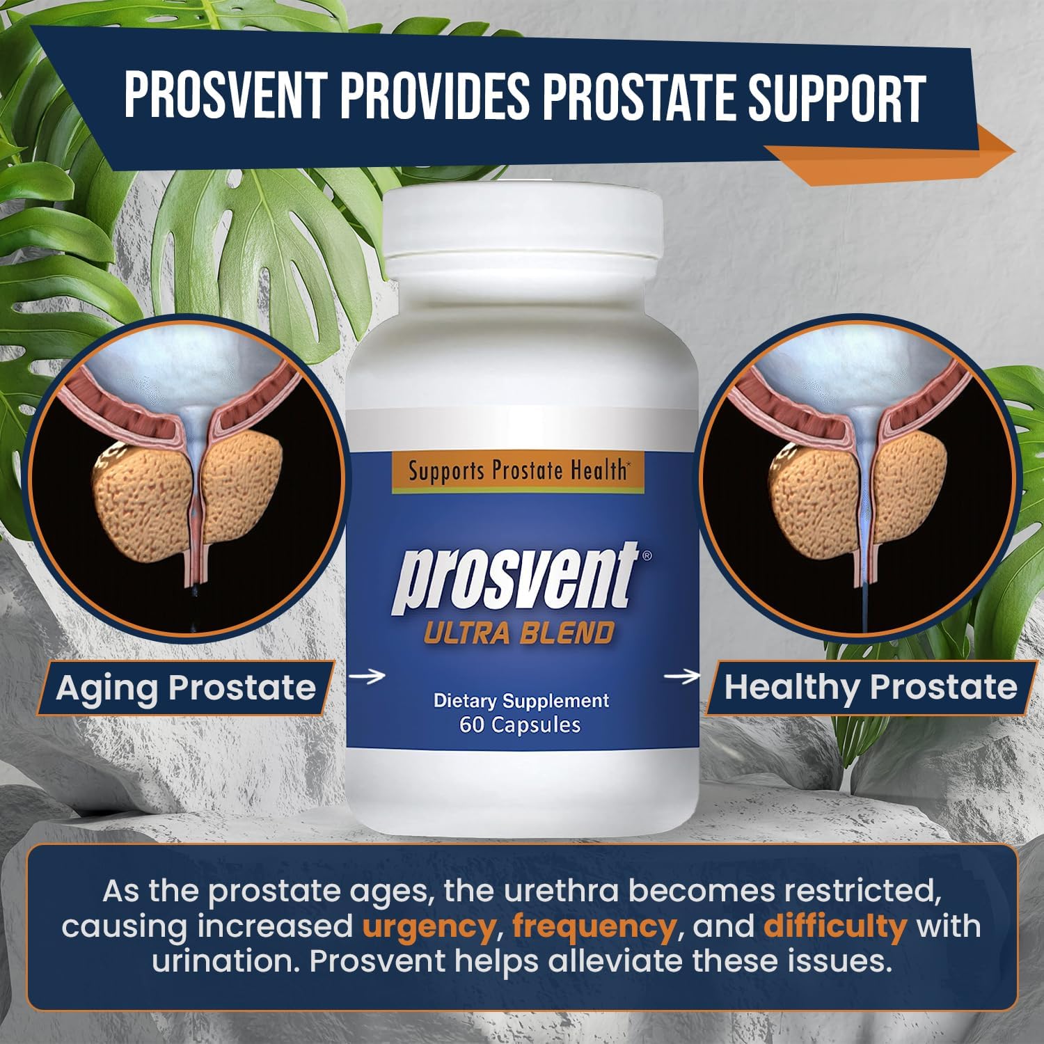 Prosvent Advanced Prostate Support Supplement - Natural Blend with Saw Palmetto, Pygeum, Lycopene, Stinging Nettle, Beta Sitosterol, Cranberry - 60 Capsules