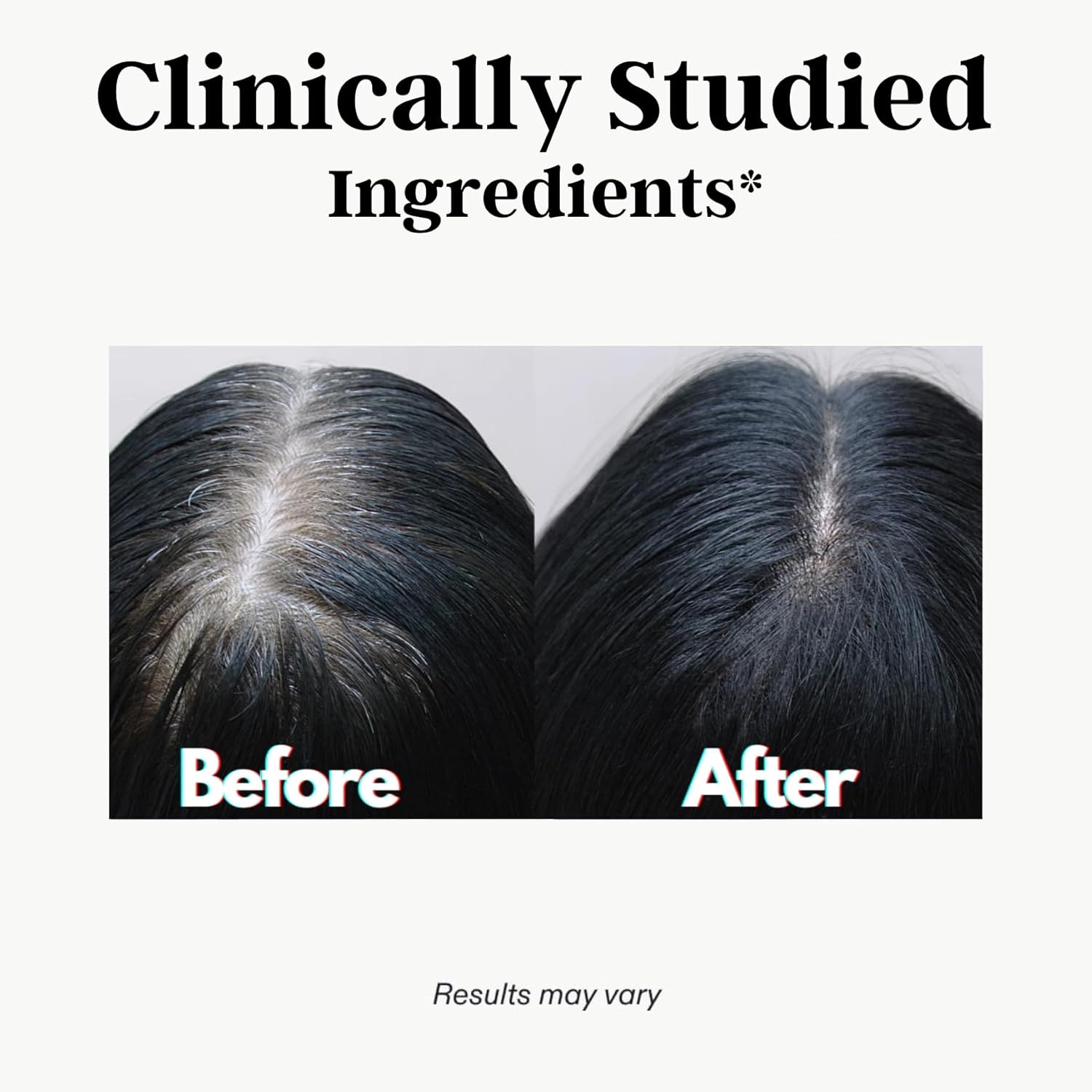 Reverse Gray Hair with Catalase - Antiaging Hair, Skin, and Nails Vitamins for Men and Women