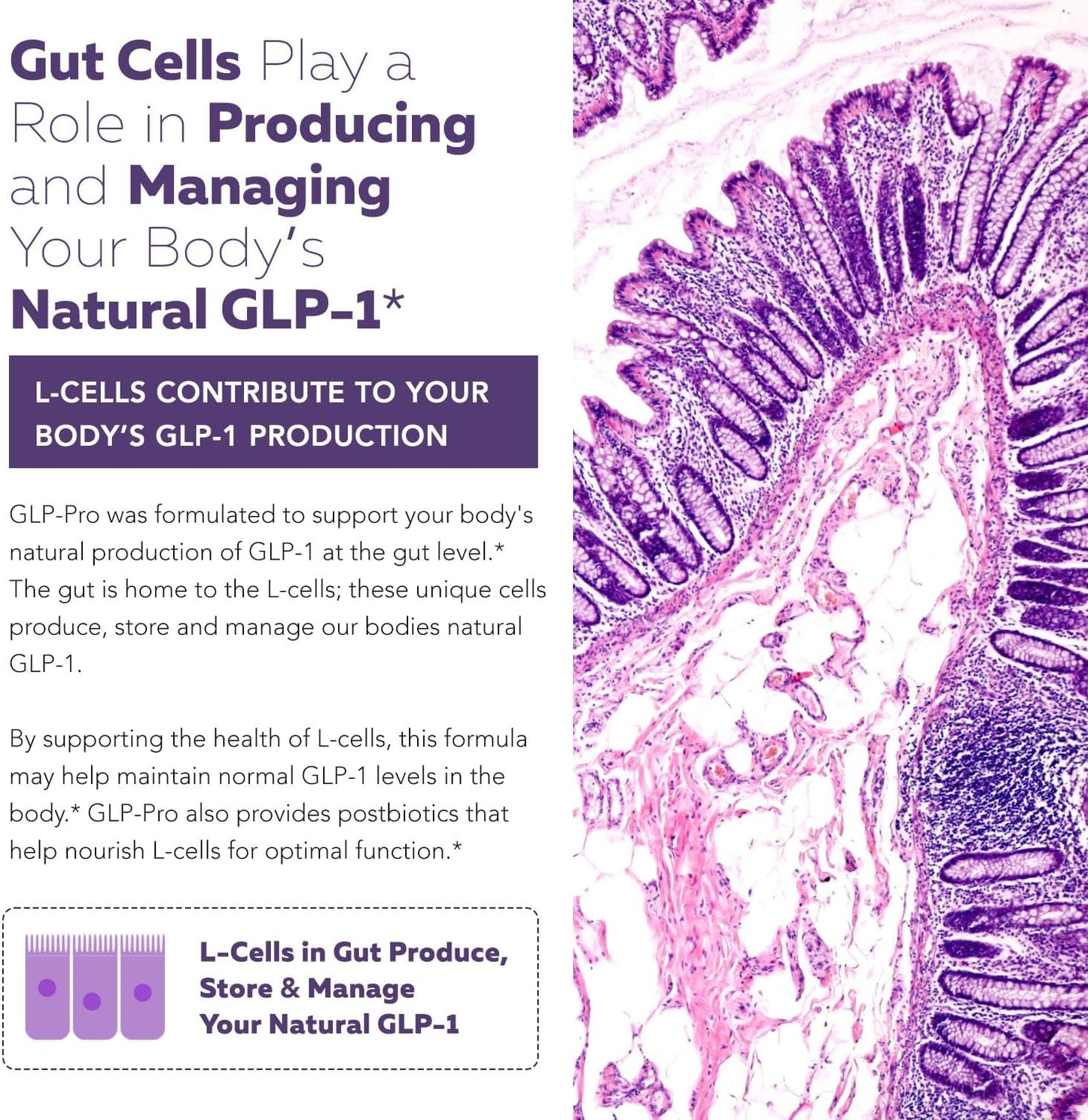 Triquetra Health GLP-Pro: Probiotic for GLP-1 Support with Akkermansia, Spore Forming Probiotics, and Butyrate - 30 Count