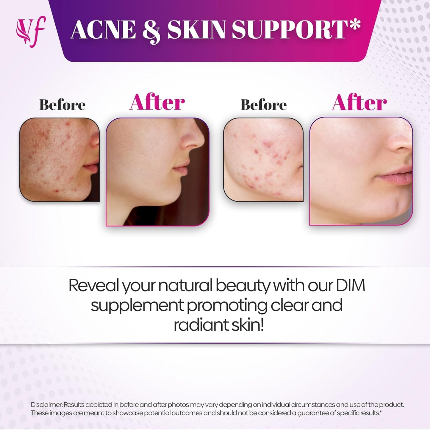 Vitafemi Extra Strength DIM 350mg with BioPerine for Hormone Balance, Estrogen Balance, Acne & Menopause Relief - 60 Capsules