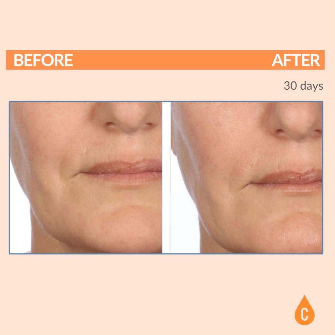 Vitamin C Ester Pads with Hyaluronic Acid for Anti-Aging Facial Treatment - Fruit Extracts - Pre-Soaked Facial Disc - 60 Count