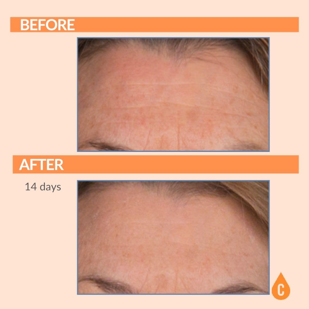 Vitamin C Ester Pads with Hyaluronic Acid for Anti-Aging Facial Treatment - Fruit Extracts - Pre-Soaked Facial Disc - 60 Count