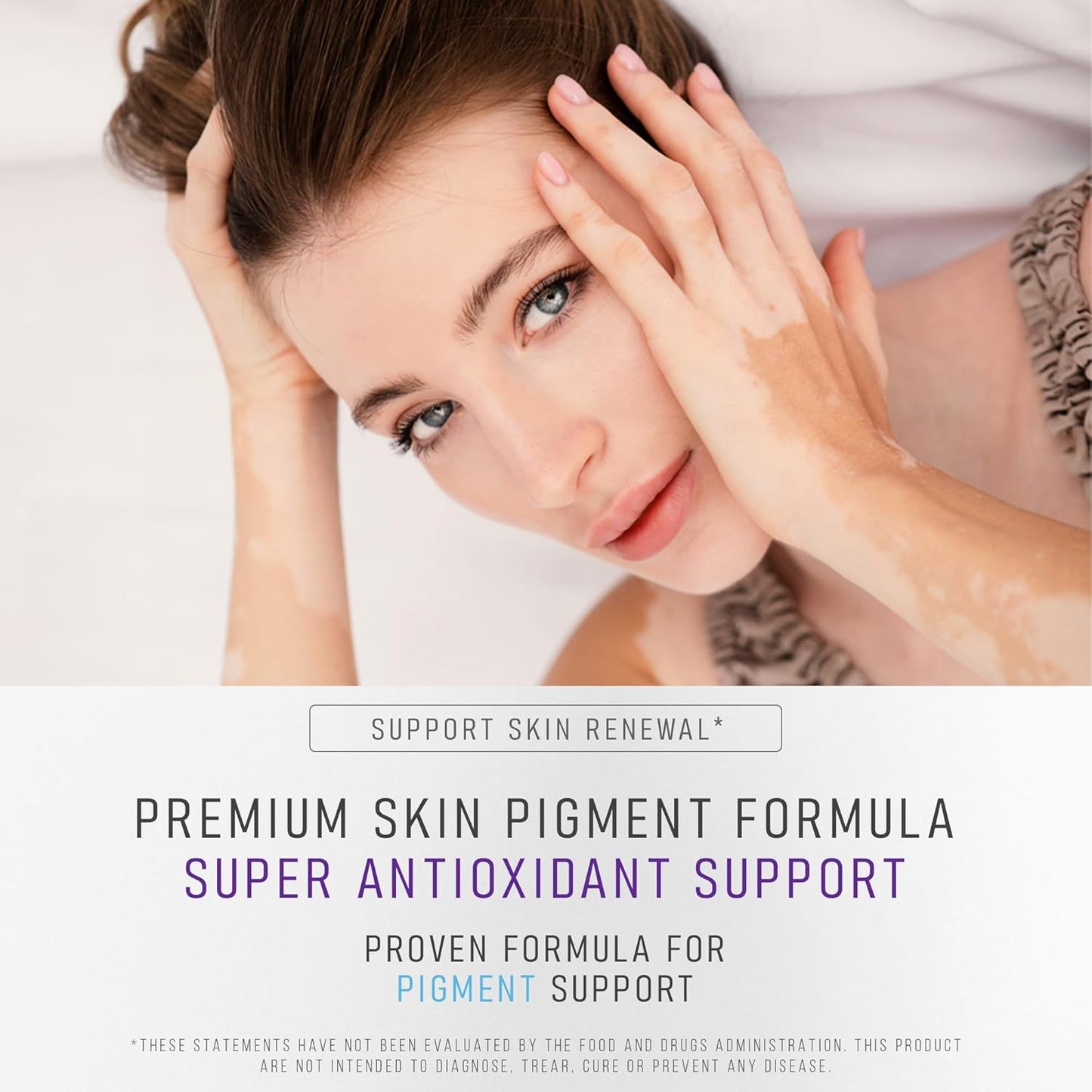 Vitiligo Supplement Capsules for Skin Pigmentation Support | 60 Count | Reduce White Spots | Natural Solution for Vitiligo | 1 Month Supply