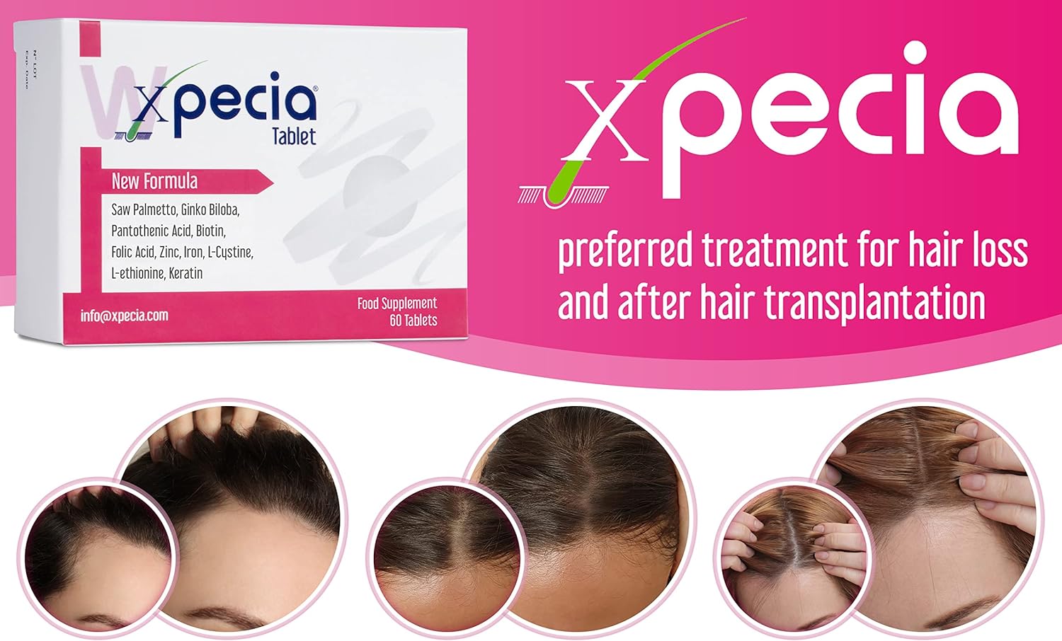 Women's Hair Loss Supplement - DHT Blocker & Hair Growth Formula - 60 Tablets