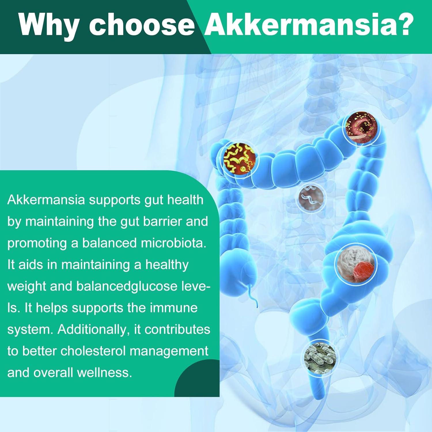 30 Day Supply of inGreens Akkermansia Muciniphila Probiotic with Chicory Inulin, Turmeric, Resistant Starch - Vegan & Gluten Free Gut Management Supplement