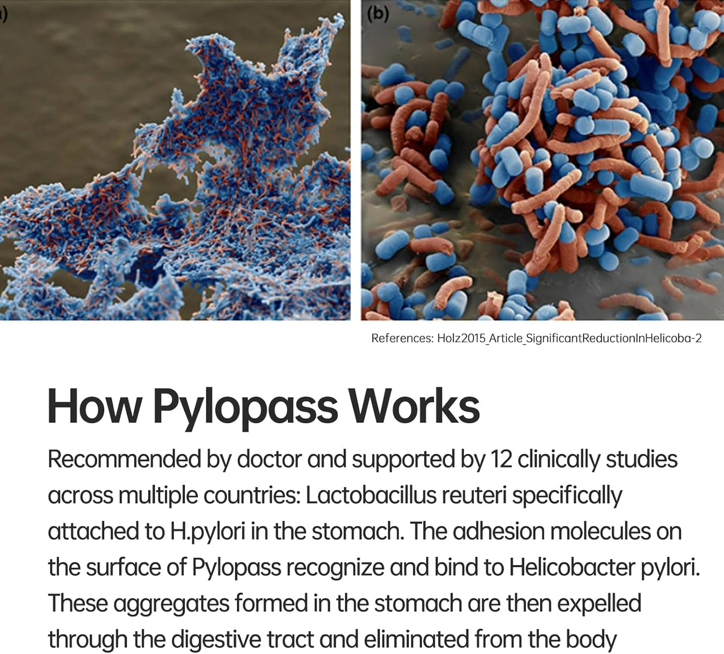 5-in-1 High Potency H. Pylori Treatment Probiotics - Gastritis, Acid Reflux Relief - Pylopass L. Reuteri - No Refrigeration
