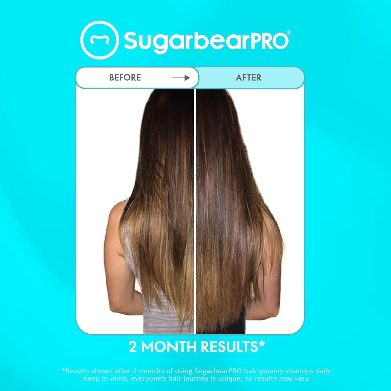 6 Month Supply of SugarbearPro Gentle Detangling Bamboo Hair Brush & Vegan Hair Vitamin Gummies with Extra Strength Biotin 6000mcg for Healthy Hair Types
