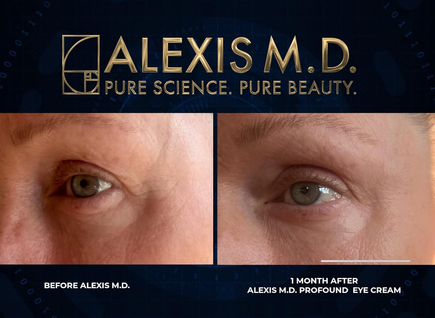 ALEXIS M.D. Profound C Complex - 20% Vitamin C and Glutathione Serum - 30ml Bottle