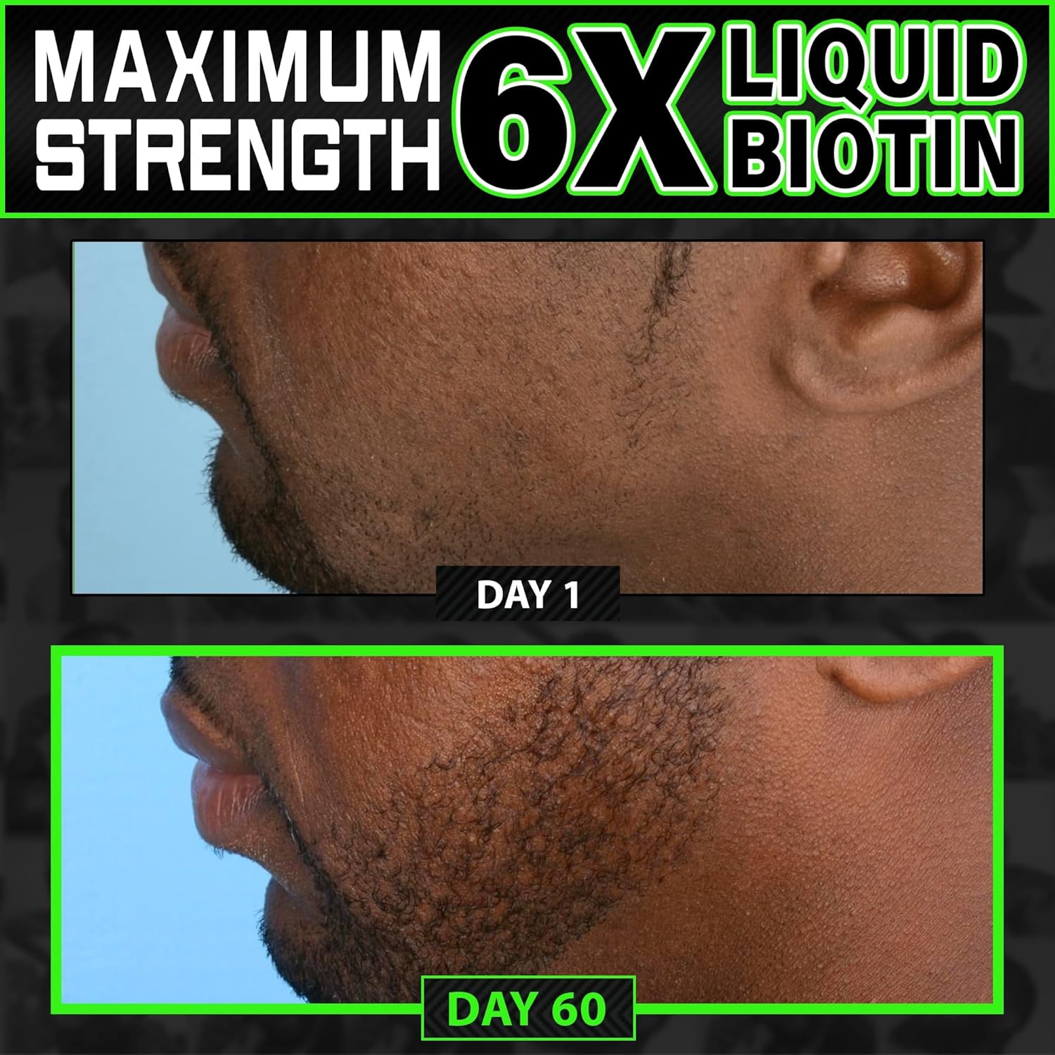 BBS USA Maximum Strength Biotin & Collagen Liquid for Men Hair & Beard Growth - 6X Absorption (2 OZ)
