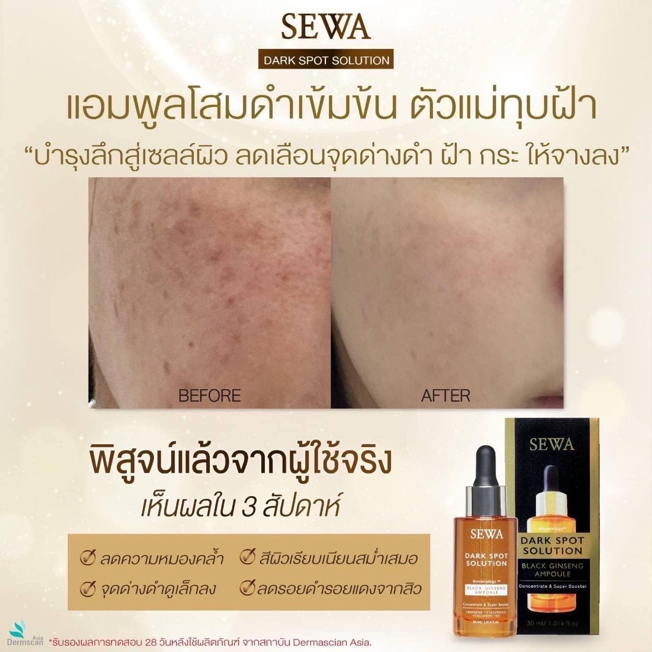 Black Ginseng Ampoule Concentrate Dark Spot Solution & Super Booster 30ml - Melasma Treatment - 1.01 Fl Oz