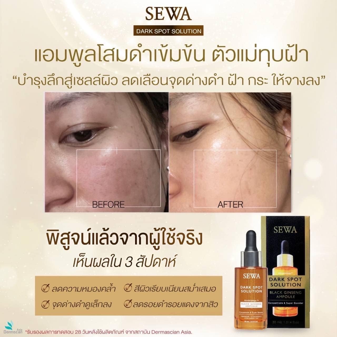 Black Ginseng Ampoule Concentrate Dark Spot Solution & Super Booster 30ml - Melasma Treatment - 1.01 Fl Oz