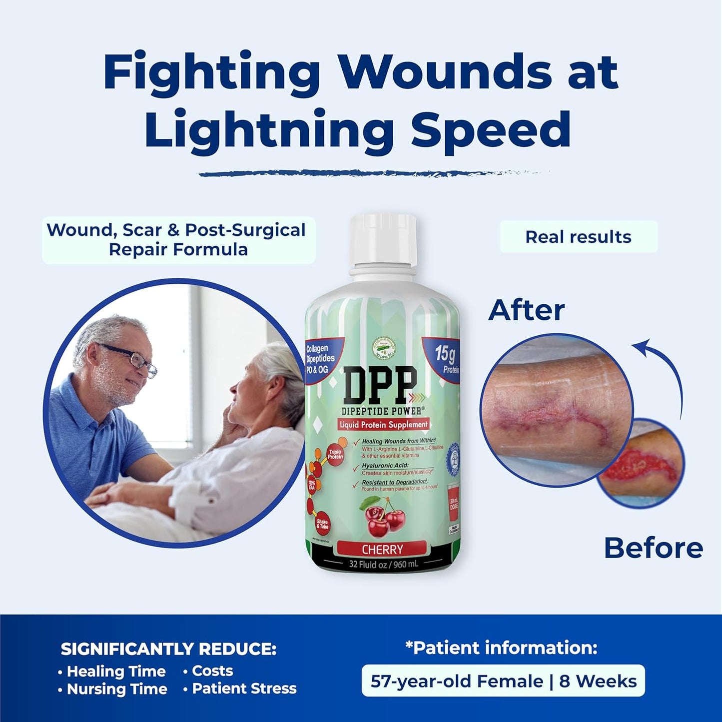 Cherry Flavored Liquid Collagen & Whey Protein Supplement for Healthy Skin & Hair, Sugar-Free, 32 Fl Oz Bottle