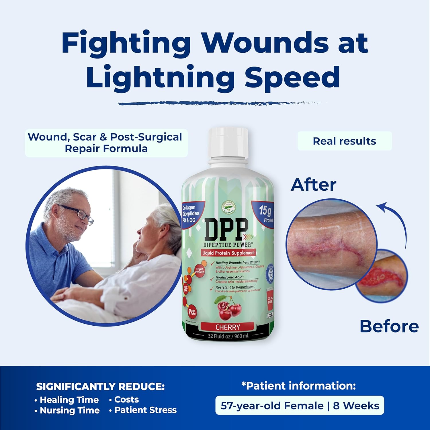 Cherry Flavored Liquid Collagen & Whey Protein Supplement for Healthy Skin & Hair, Sugar-Free, 32 Fl Oz Bottle