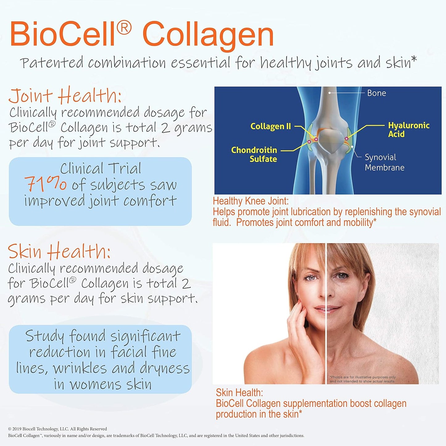 Doctor's Best Hyaluronic Acid and Chondroitin Sulfate with BioCell Collagen - Joint Support Supplement, 180 Count