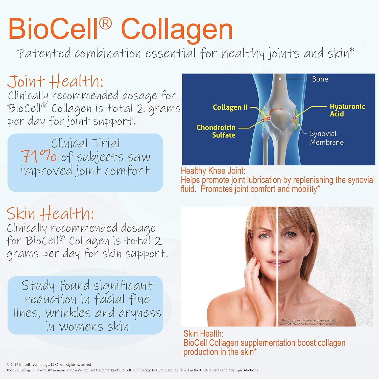 Doctor's Best Hyaluronic Acid and Chondroitin Sulfate with BioCell Collagen - Joint Support Supplement, 180 Count