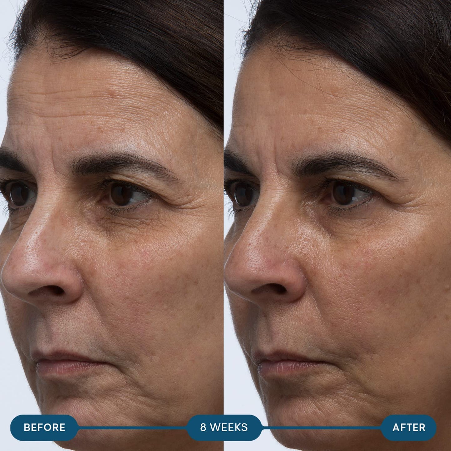 ELEMIS Pro-Collagen Skin Future Supplements - Reduce Fine Lines & Wrinkles, Hydrate & Improve Elasticity - 60 Capsules