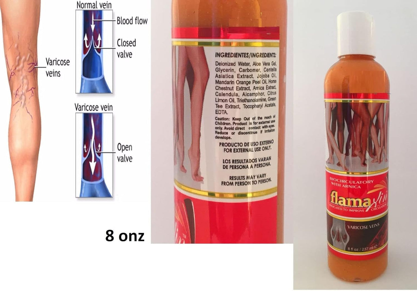 Flamaxin Cream: Natural Solution for Varicose Veins, Anti-Inflammatory Cream for Circulation Problems