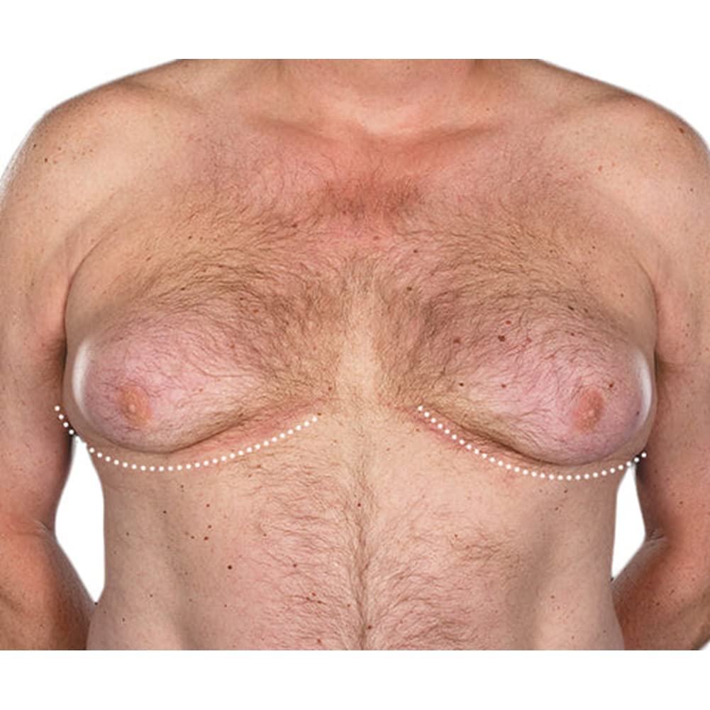 Gynecomastia Tightening Ginger Cream - Improves Elasticity & Burns Fats for Firm Male Chest Shape